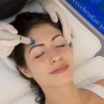 Hydrafacial for Acne-Prone Skin