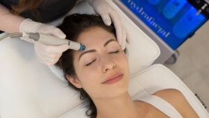 Hydrafacial for Acne-Prone Skin