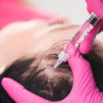 PRP for Hair Loss treatment for natural hair regrowth and thicker hair