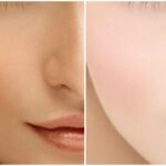 Skin Whitening for Oily Skin