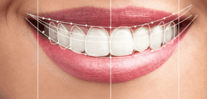 Italian Dental Clinic Dubai