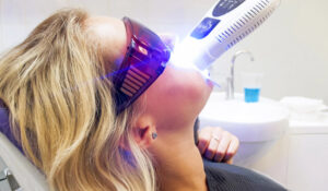 Laser Teeth Whitening in Islamabad