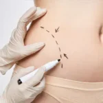 body-contouring-in-Dubai