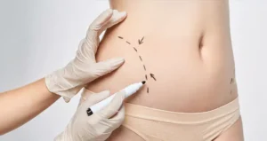 body-contouring-in-Dubai