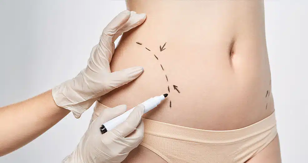 body-contouring-in-Dubai