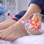 Peripheral Nerve Repair