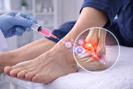 Peripheral Nerve Repair