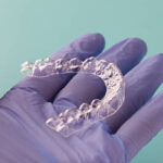 The Essential Role of Teeth Retainers in Islamabad for Lasting Smile Stability