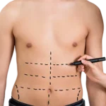 six-pack-design