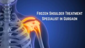 Frozen Shoulder Treatment Specialist Gurgaon