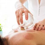 cupping1