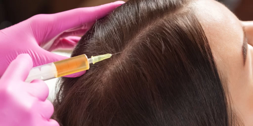 exosomes hair therapy in Islamabad