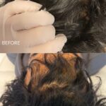 imgi_8_The-Hairboost-Clinic-19-updated-2