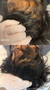 imgi_8_The-Hairboost-Clinic-19-updated-2