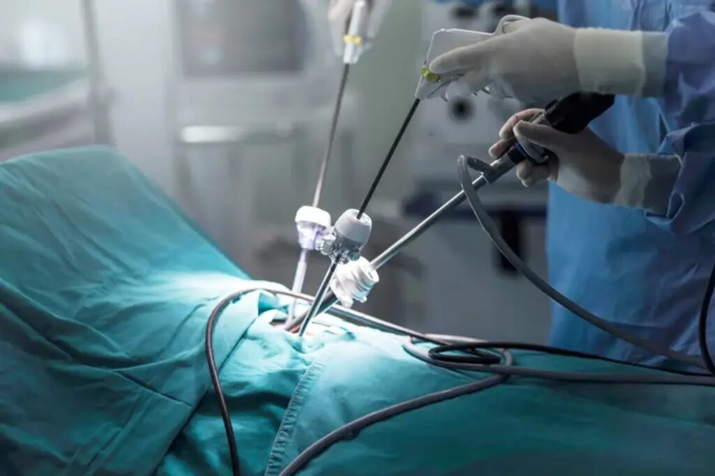 laparoscopic surgery in Islamabad