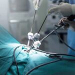 laparoscopic surgery in Islamabad