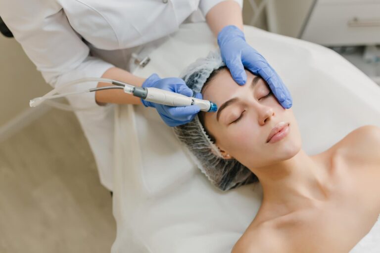 HydraFacial for Acne, Dull Skin & Open Pores