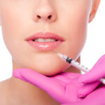 Lip Fillers Dubai