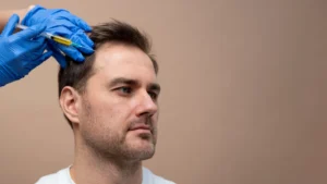 PRP therapy hair treatment