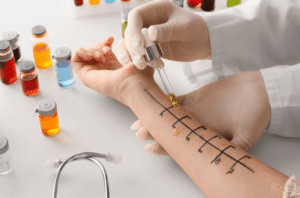 allergy-testing-in-dubai