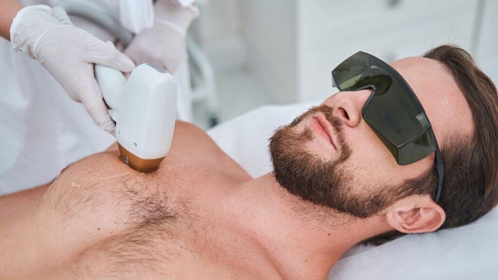 laser hair removal for men