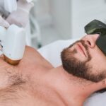 laser hair removal for men