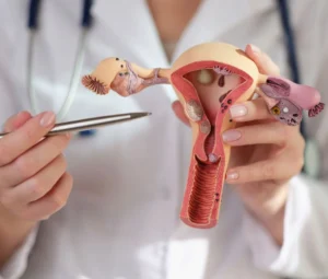 Polycystic Ovary Syndrome Treatment In Dubai