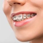 orthodontics-2 (1)