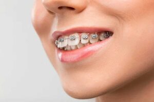 orthodontics-2 (1)