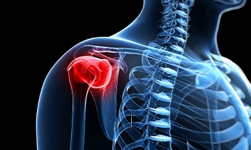 stem-cell-treatment-and-torn-rotator-cuff-2