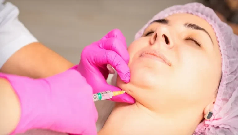 Kybella san ramon