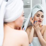 acne hormonal treatment Toronto