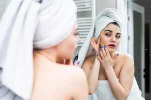 acne hormonal treatment Toronto