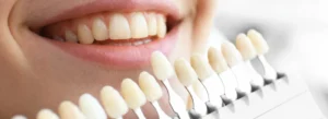 Are Ceramic Veneers Right for You