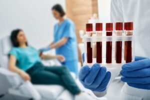 Blood-Test-Near-Me