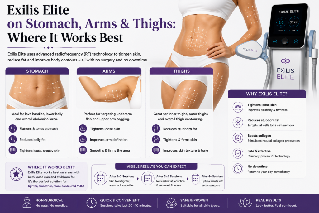 Exilis Elite on Stomach, Arms & Thighs: Where It Works Best