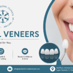 Dental Veneers in Islamabad