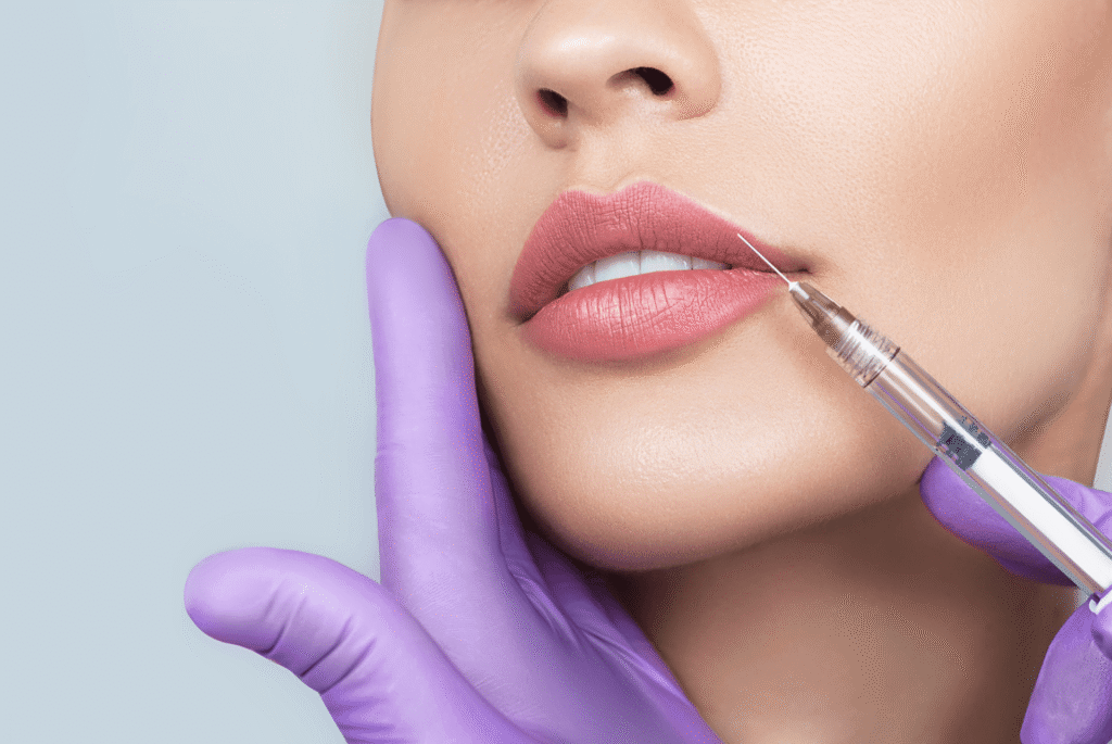 Juvederm-Fillers-London