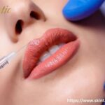 Lip Fillers Riverside