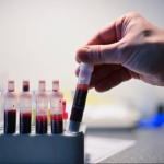 Blood Drug Testing