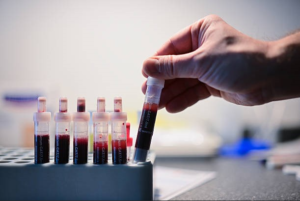 Blood Drug Testing