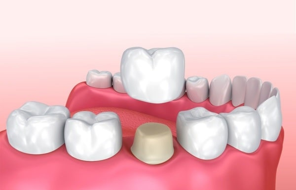 5de1031f61437