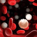 Anemia
