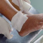 chronic wound care Genesee MI