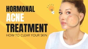 Hormonal skin ageing treatment