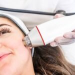 Radiofrequency Microneedling in Dubai