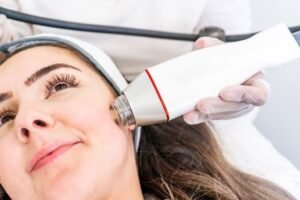 Radiofrequency Microneedling in Dubai
