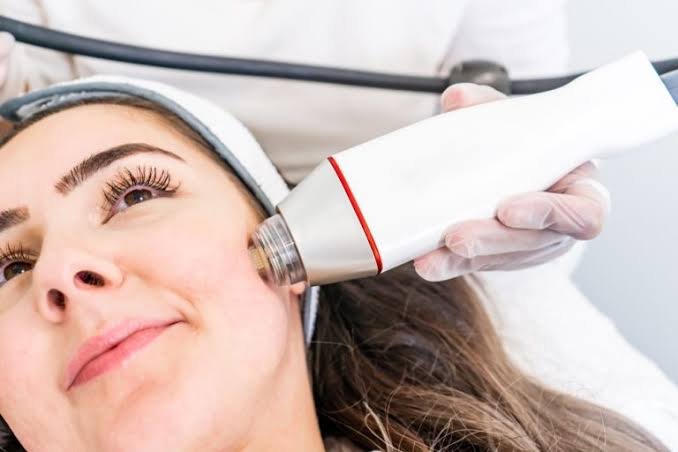 Radiofrequency Microneedling in Dubai