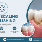 Teeth Scaling and Polishing in Islamabad