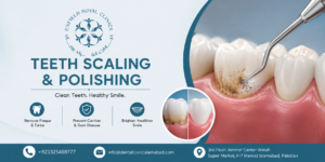 Teeth Scaling and Polishing in Islamabad